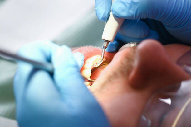 Best Tooth Pain Emergency Relief  in Montrose, MI