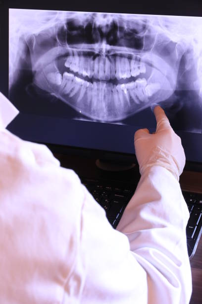 Best Dentist for Tooth Abscess  in Montrose, MI